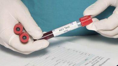 Photo of Assam Records Highest HIV Cases In Northeast