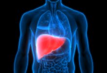 Photo of In a first, state to screen 3 lakh people over 3 years for fatty liver