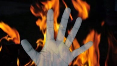 Photo of  हाईवे पर जली हालत में मिली नवविवाहिता