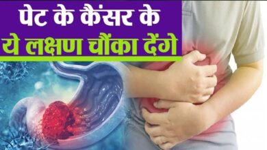 Photo of  पेट का कैंसर होने पर चेहरे पर दिखने लगते हैं ये लक्षण, बिल्कुल न करें नजरअंदाज