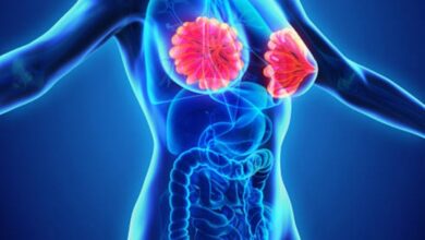 Photo of क्या ब्रेस्ट में गांठ होना हमेशा होता है स्तन कैंसर