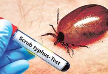 Photo of आंध्र प्रदेश में ‘स्क्रब टाइफस’ से अब तक पांच की माैत, स्वास्थ्य विभाग अलर्ट